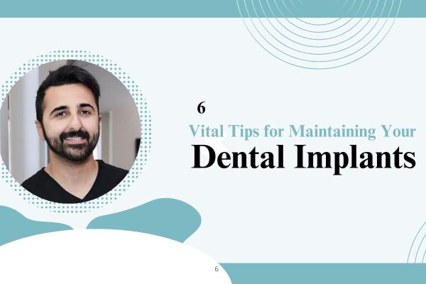 6 Vital Tips for Maintaining Your Dental Implants