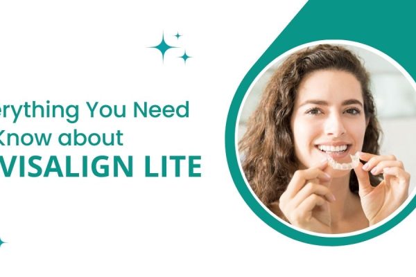 Everything You Need to Know about Invisalign Lite