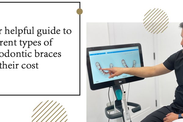 Your-helpful-guide-to-different-types-of-orthodontic-braces-and-their-cost
